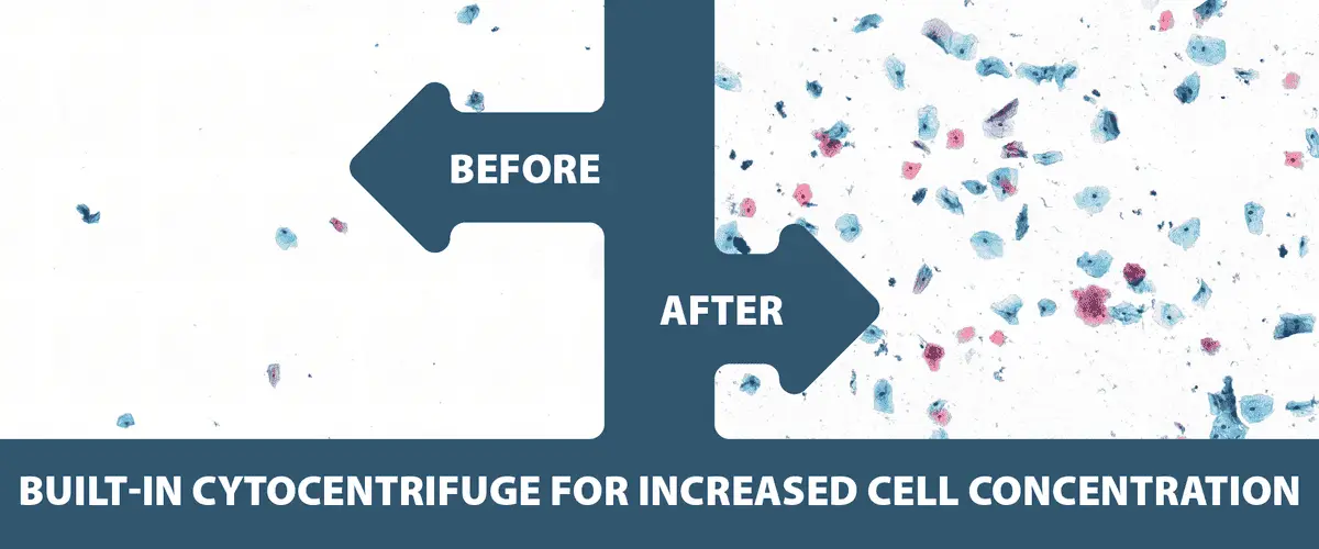 Built-in cytocentrifuge for increased cell concentration.