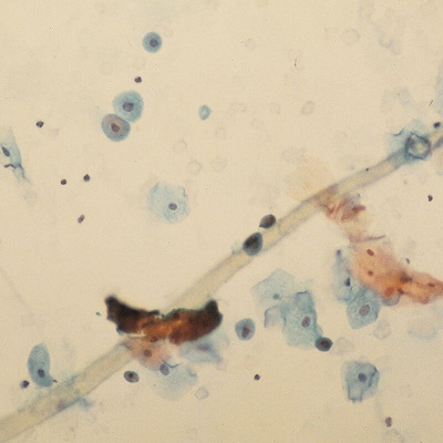 Cells on Microscope Slide