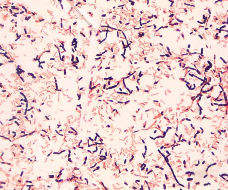 Cells on Microscope Slide