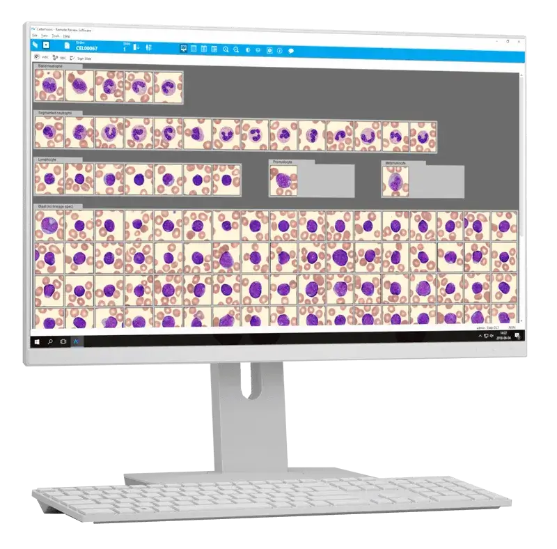 Peripheral Bood Application that accompanies the CellaVision Digital Analyzers